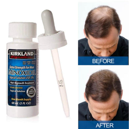 MINOXIDIL - TÓNICO PARA CRECIMIENTO DE CABELLO Y BARBA